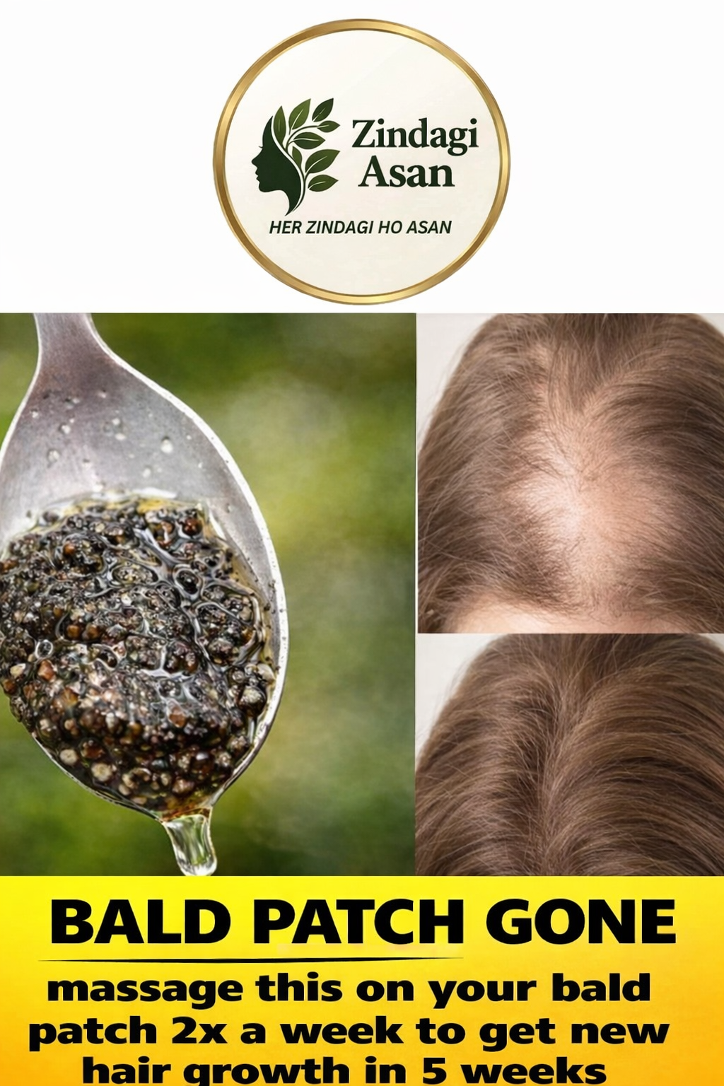 Best Hair Oils For Hair Growth: Stop Hair Fall, Fast Hair Growth